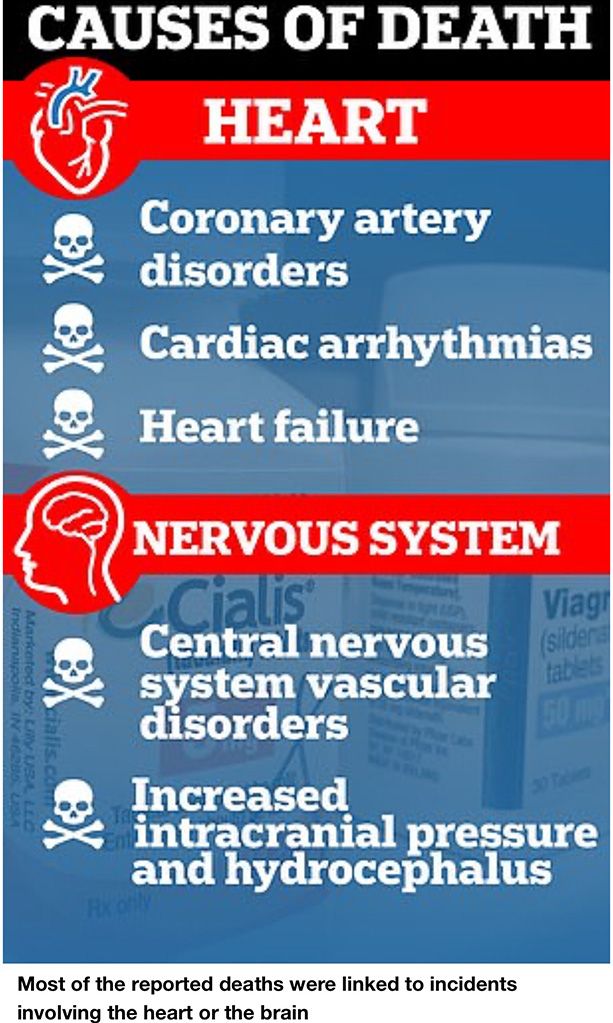 Causes of death article